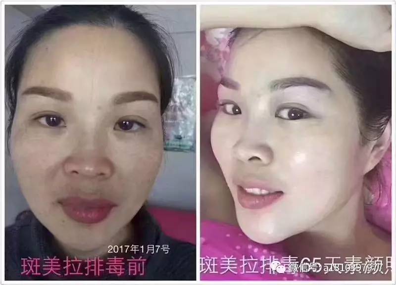 最新斑美拉消息引领时尚潮流风向标