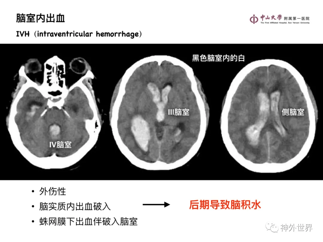 最新CT技术革新与应用概览